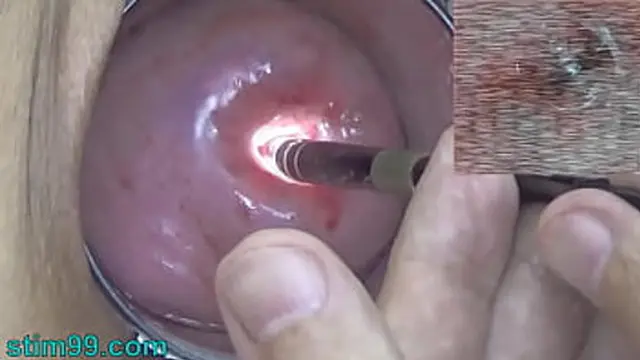 Examination of Cervix with Endoscope; GYN Doctor Inspects My Vagina🌮️ and Womb